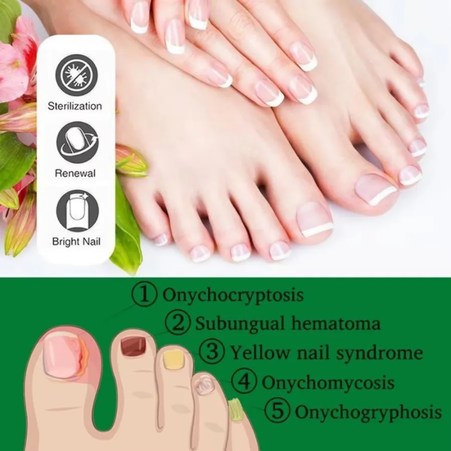 Dermfree Fungi Nail Ointment 0.5 fl oz (15 mL) view 4